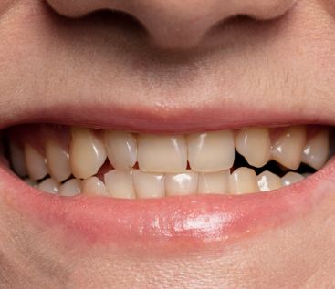 Dental Clinic near Shankar Nagar