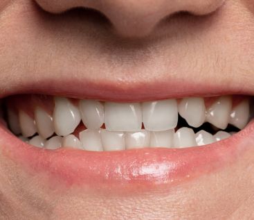 Dental Clinic near Shankar Nagar